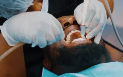 Curățarea dinților în apropierea gingiei cu instrumente dentare.