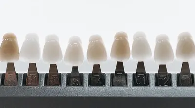 Mostre ceramice de nuanțe dentare, folosite la alegerea culorii unei coroane.